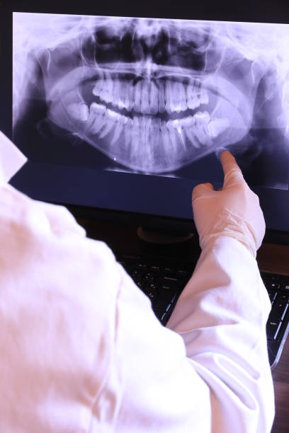 Best Broken or Cracked Tooth Emergency Dentist in Carson, WA